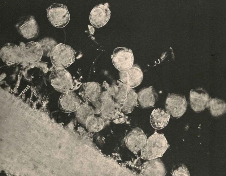 Photomicrograph of Vorticella