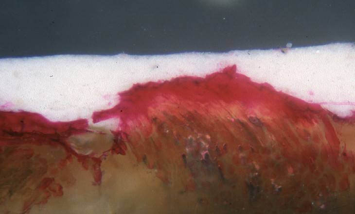 Cross-section from the primed tacking margin from Spencer Gore's 'Richmond Park', stained for proteinaceous material with aqueous acid fuchsin (original magnification 125x).