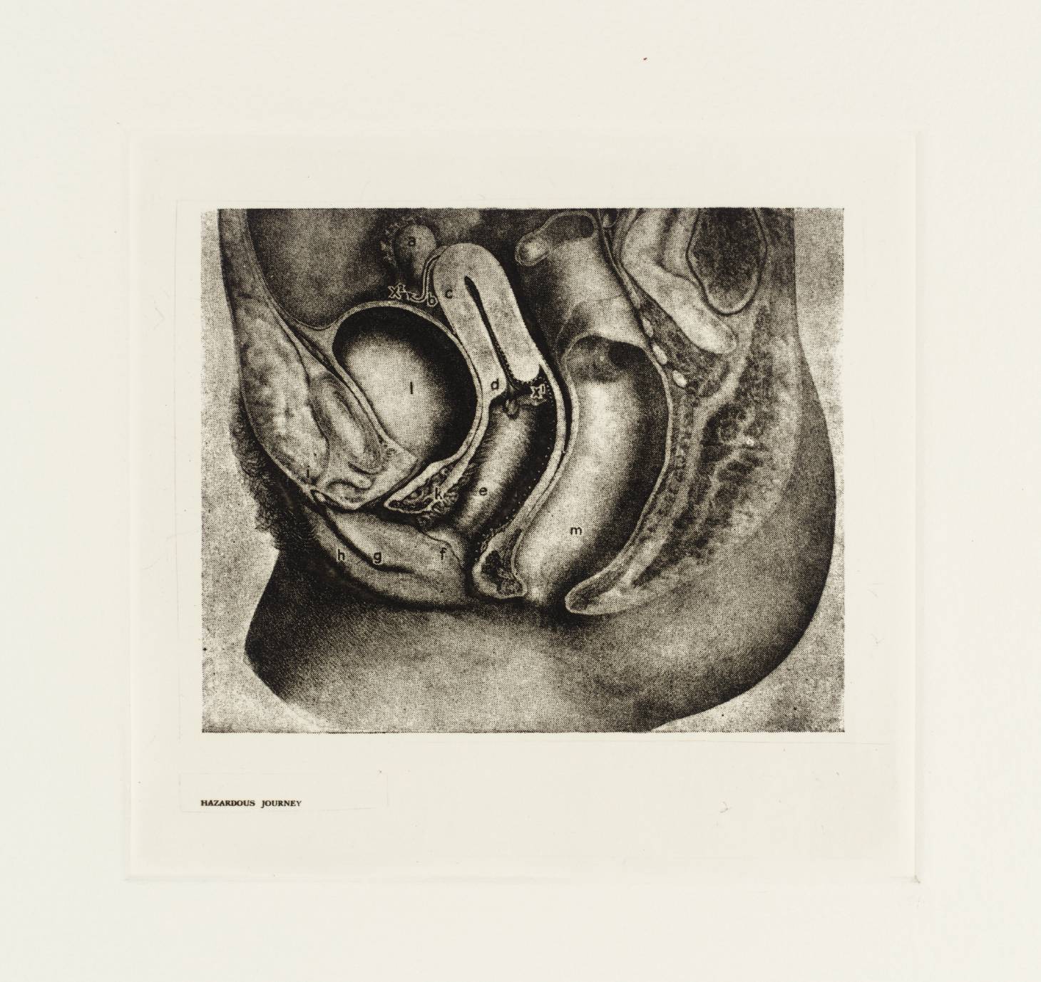 Secrets of Life - The Human Machine and How it Works: Hazardous Journey