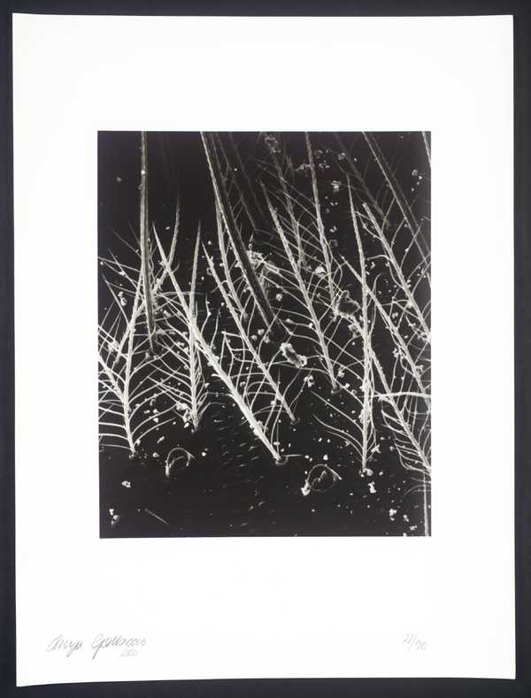 Spider’s Leg at 400 x