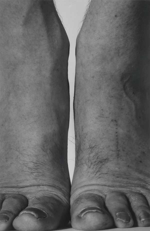 Self-Portrait (Feet Frontal)