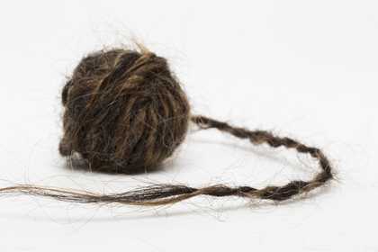 ​Sanne Visser. The New age of Trichology, Caucasian Hair.
