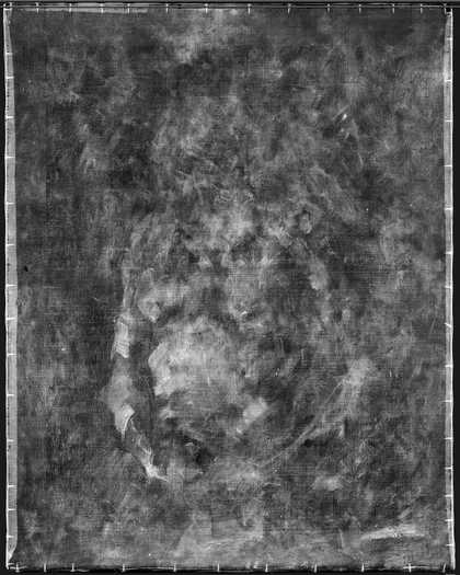 X-radiograph
