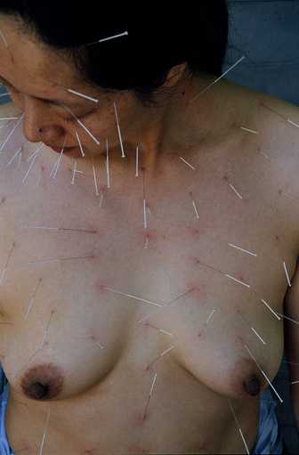 He Chengyao, 99 Needles 2002, Chromogenic photograph, Image courtesy of the artist