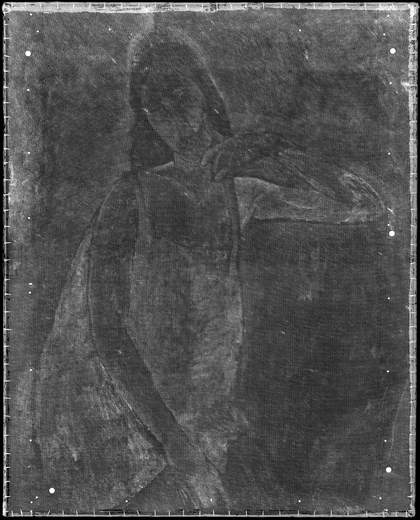 X-radiograph image of fig.6