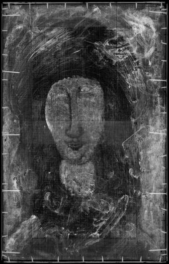 X-radiograph image of fig.8