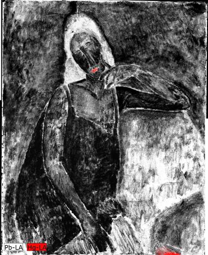 White areas (indicating lead) are prominent on the hair and the armchair. Red (indicating mercury) is most prominent on the lips