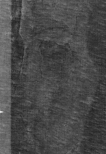 An X-radiograph detail showing alterations to the angle of the face