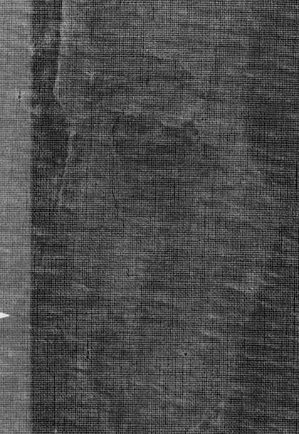 An X-radiograph detail showing alterations to the angle of the face