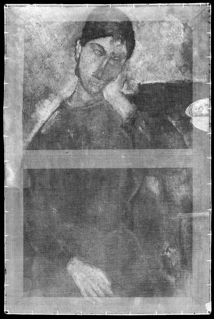 Black-and-white x-radiograph image, showing the image and the frame behind.