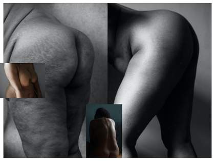 A composite image made of four photographs. The two larger black and white images in the background show profile views of the hips, buttocks and thighs of two women. The two smaller colour images show a woman’s upper body and back.
