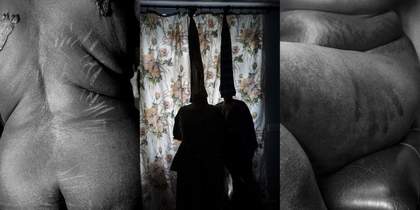 A triptych, in which the central photograph is in colour and shows two figures standing in silhouette in front of a flower-patterned curtain. The black and white images on either side show a back marked by lines, and a handprint is visible on the thigh.