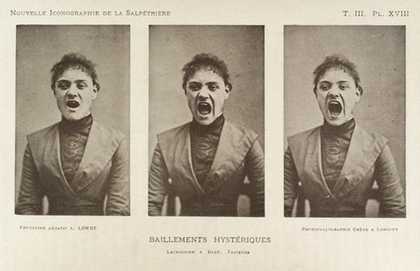 Albert Londes photograph entitled Hysterical Yawning