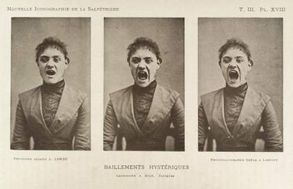 Albert Londes photograph entitled Hysterical Yawning