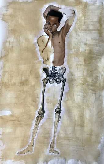 painting of a young boy with an exposed skeleton from the hips down