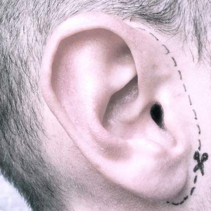 Detachable Ears - RadioCity