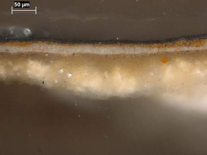 Fig.10 Cross-section through the black oval surround, photographed at x320 magnification.