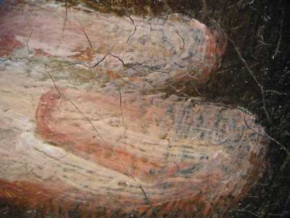 Fig.10 Extension of fingers on sitter’s right hand, photographed at x8 magnification