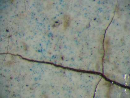 Fig.11 Detail of the blue pigment in the right eyeball, photographed at x100 magnification