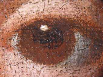 Fig.11 The sitter’s right eye photographed at x8 magnification