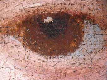 Fig.12 The sitter’s left eye at x8 magnification