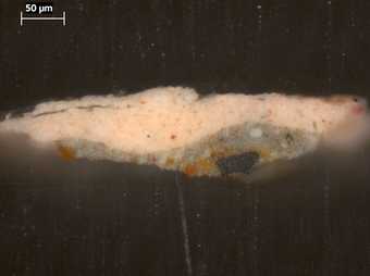 Fig.13 Cross-section through the forehead, photographed at x320 magnification.