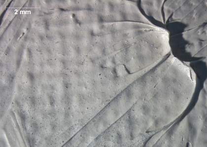 Micrograph of the earlobe