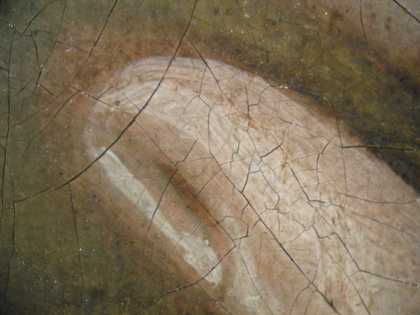 Fig.15 Detail at x8 magnification of a finger tip