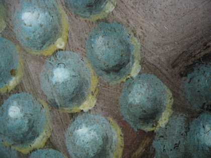  Fig.16 Pearls at the wrist at x8 magnification