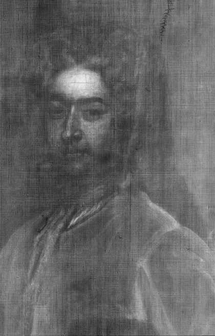 Fig.16 X-radiograph detail of the man’s head