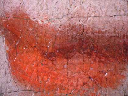 Fig.18 Detail at x10 magnification of the lips of the boy on the right