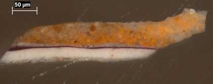 Fig.20 Cross-section through the patterned dress, photographed at x320 magnification.