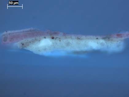 Fig.24 Cross-section through a site close to that illustrated in fig.22, photographed at x320 magnification in ultraviolet light