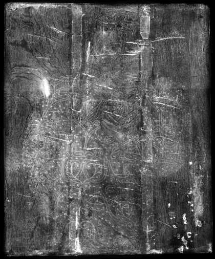 Fig.2 X-radiograph of Portrait of an Unknown Lady c.1595