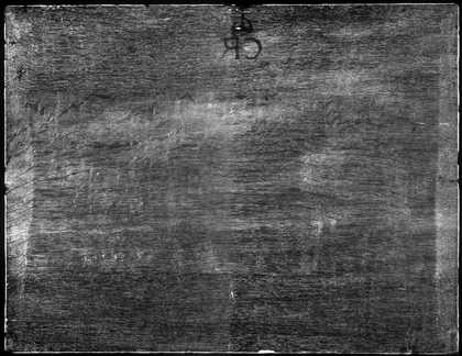 Fig.2 X-radiograph of Distant View of York 1639