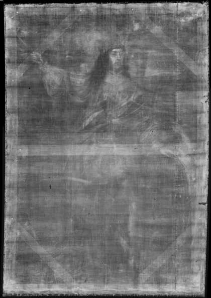 Fig.2 X-radiograph of Sir Neil O’Neill 1680