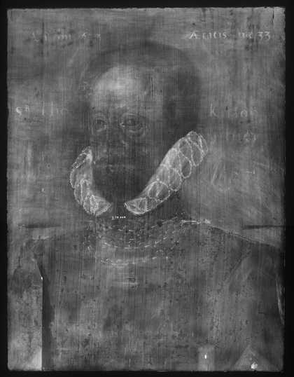 Fig.2 X-radiograph of Sir Thomas Kytson