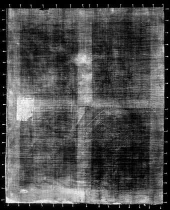 Fig.2 X-radiograph of Cornelia Veth