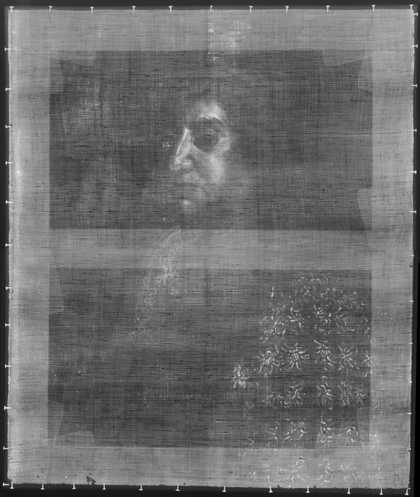 Fig.2 X-radiograph of The First Marquess of Tweeddale