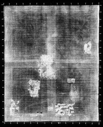 Fig.3 X-radiograph of Apolonius Veth