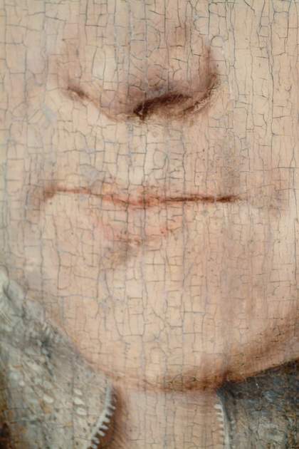 Fig.3 Detail of the sitter’s nose and mouth