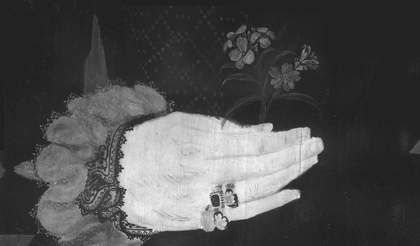 Fig.4 Infrared reflectogram of the sitter’s right hand