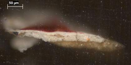 Fig.4 Cross-section through the patterned skirt at the lower edge, photographed at x320 magnification.