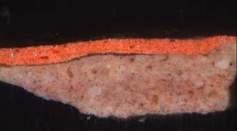Fig.5 Cross-section through the sitter’s left stocking, photographed at x250 magnification.