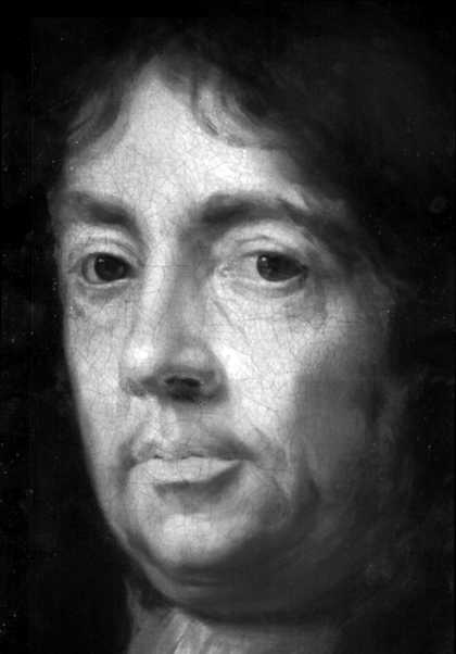 Fig.5 Infra-red detail of face