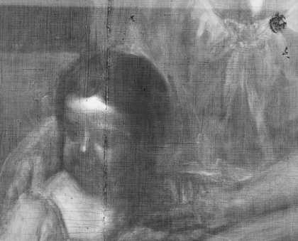 Fig.6 X-radiograph of the youngest child’s head, showing the seam joining the two pieces of canvas