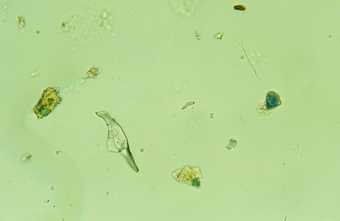  Fig.6 Particles of azurite, green earth and ground glass photographed in transmitted, polarised light at x 400 magnification. The sample is from dark green foliage