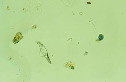 Fig.6 Particles of azurite, green earth and ground glass photographed in transmitted, polarised light at x 400 magnification. The sample is from dark green foliage