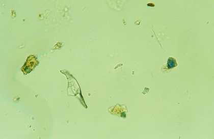  Fig.6 Particles of azurite, green earth and ground glass photographed in transmitted, polarised light at x 400 magnification. The sample is from dark green foliage