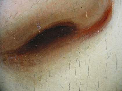 Fig.8 Detail at x8 magnification of the end of the nose